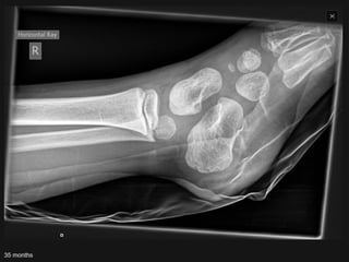 x ray,ct lower limb.pptx lower limb xray | PPTX