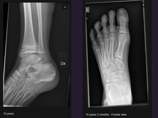 x ray,ct lower limb.pptx lower limb xray | PPTX