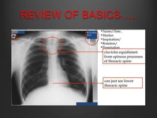 3rd Digit X Ray Routine X RAY DETERMINATION AND EVALUATION.pptx