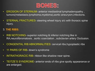 Superior Rib Notching X RAY DETERMINATION AND EVALUATION.pptx