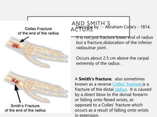 x ray diagnostics of fractures and dislocations.pptx