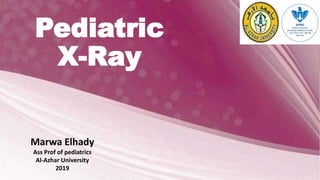 Pediatric
X-Ray
Marwa Elhady
Ass Prof of pediatrics
Al-Azhar University
2019
 