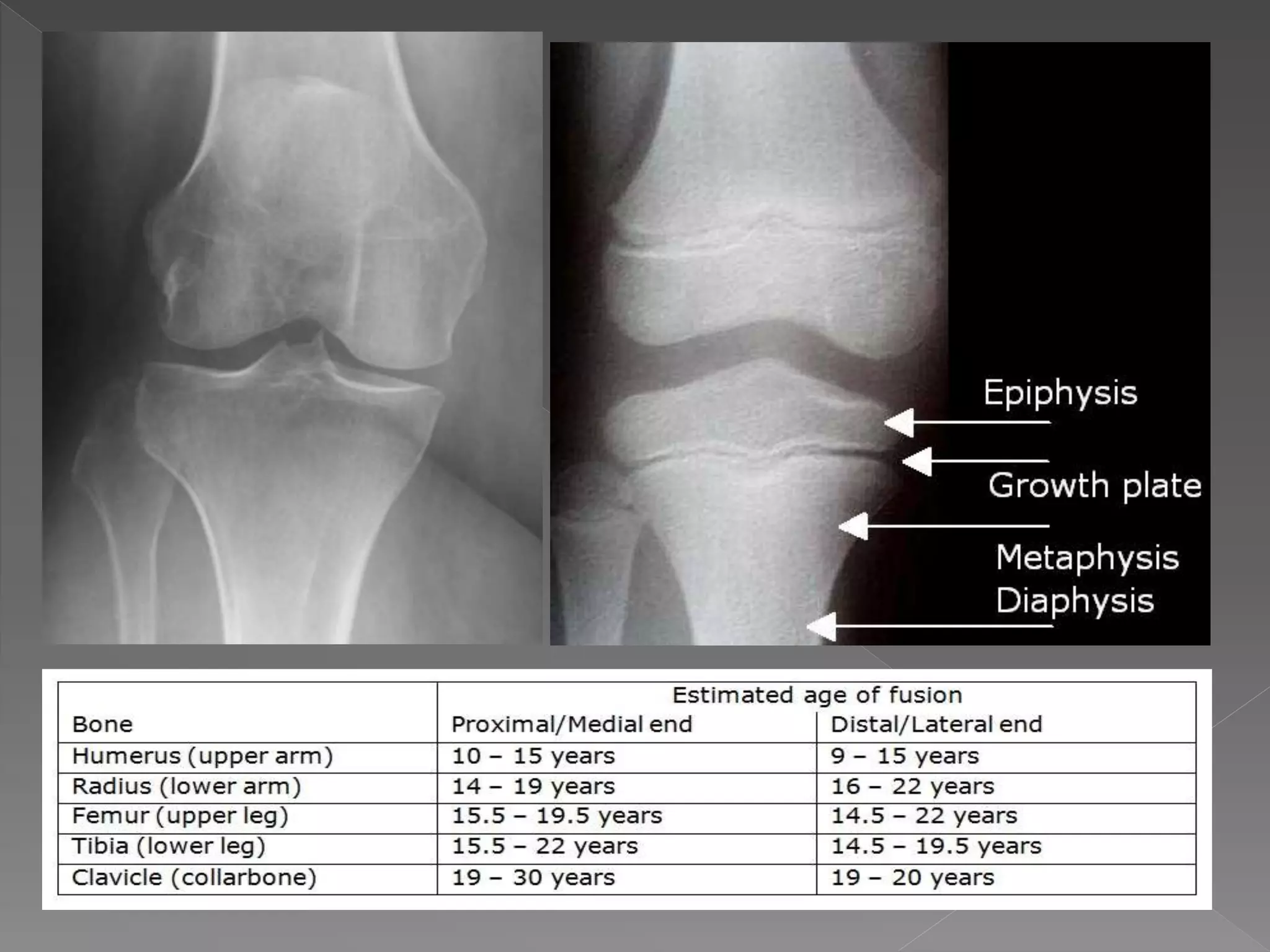 X-ray examination for determination of Age | PPTX