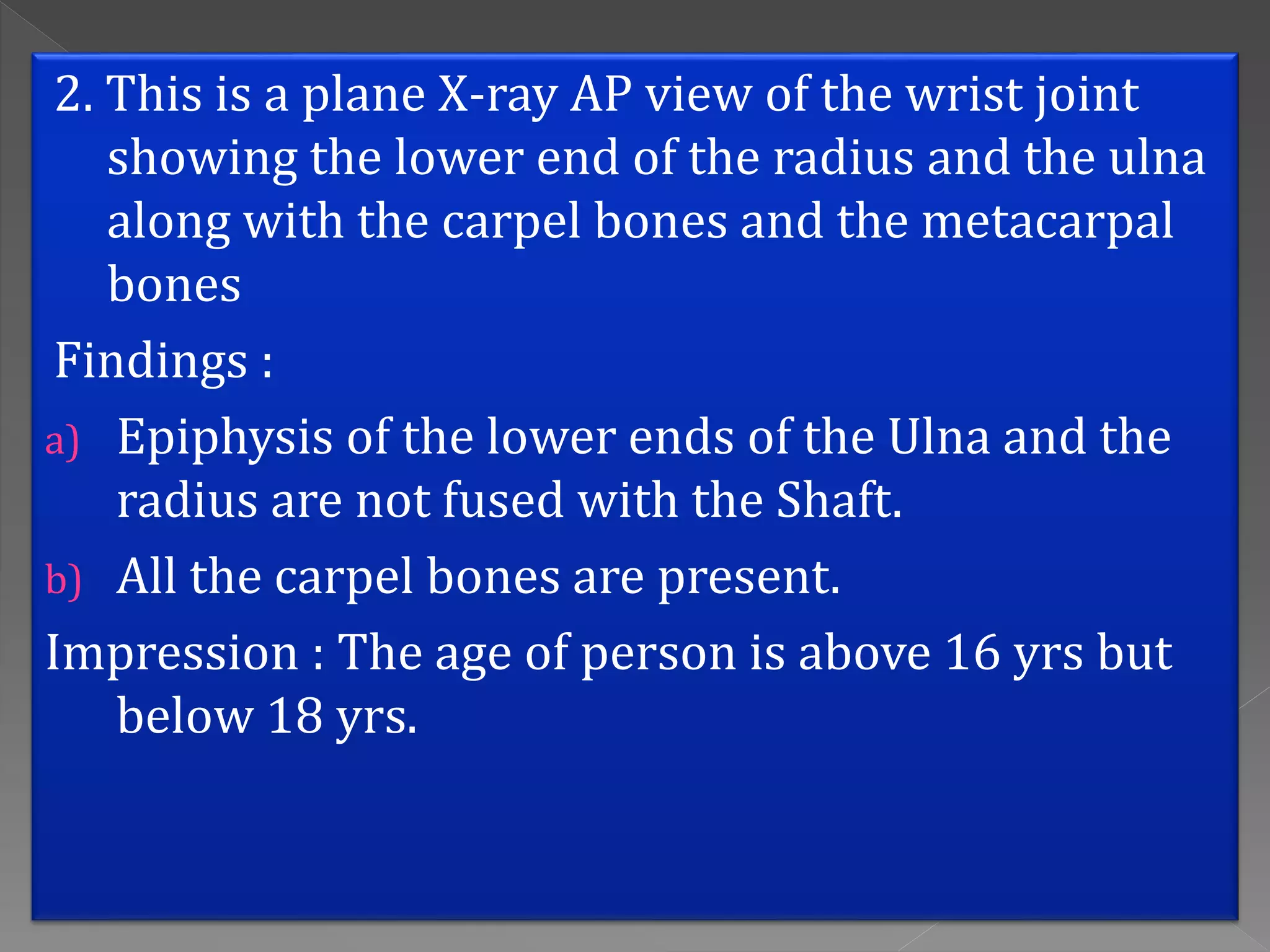 X-ray examination for determination of Age | PPTX