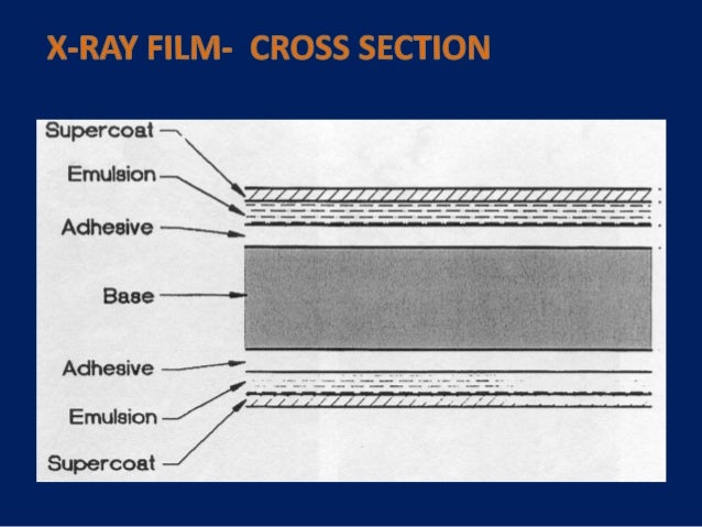 X ray film