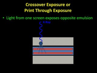 Crossover Exposure or 
Print Through Exposure 
• Light from one screen exposes opposite emulsion 
Top 
Screen 
Bottom 
Screen 
Top 
Emulsion 
Bottom 
Emulsion 
Film 
X-Ray 
 