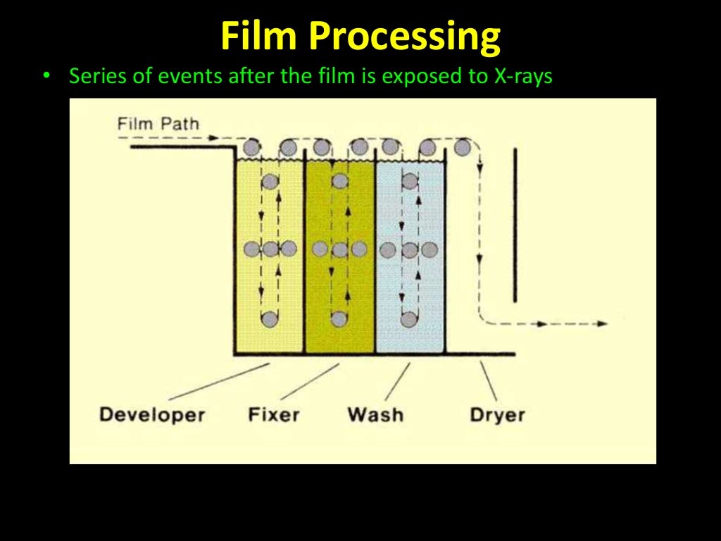 Xray film & film processing