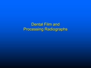 Dental Film and
Processing Radiographs
 