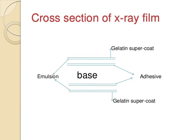 X ray films and their development by amit kumar