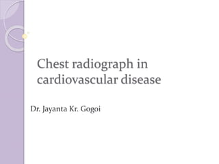 Chest radiograph in
cardiovascular disease
Dr. Jayanta Kr. Gogoi
 