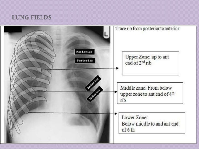 chest radiology in cardiovascular disease