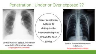 x ray approach for pediatrics and diagnosis | PPTX