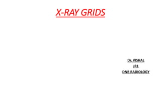 X-RAY GRIDS
Dr. VISHAL
JR1
DNB RADIOLOGY
 