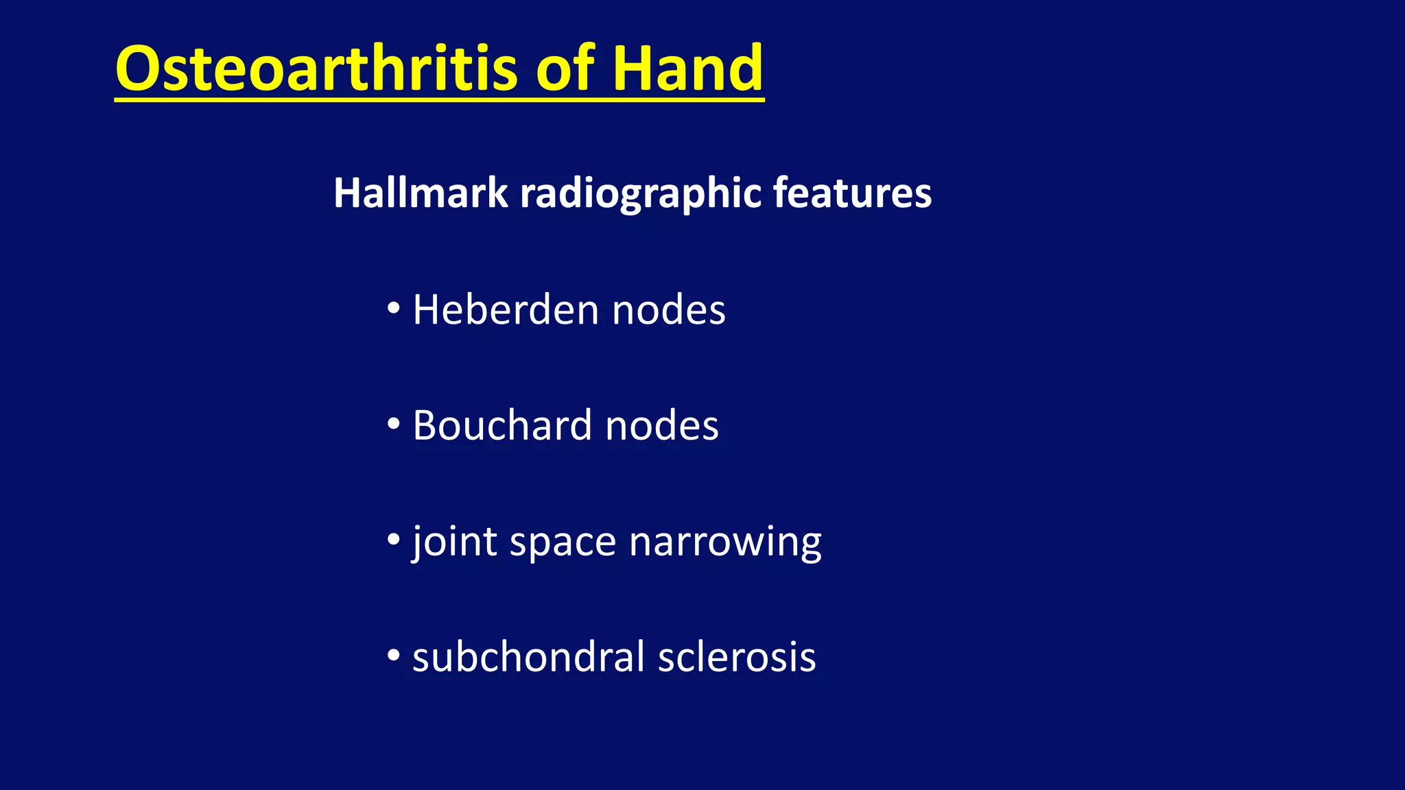 Hallmark radiographic features
• Heberden nodes
• Bouchard nodes
• joint space narrowing
• subchondral sclerosis
Osteoarthritis of Hand
 