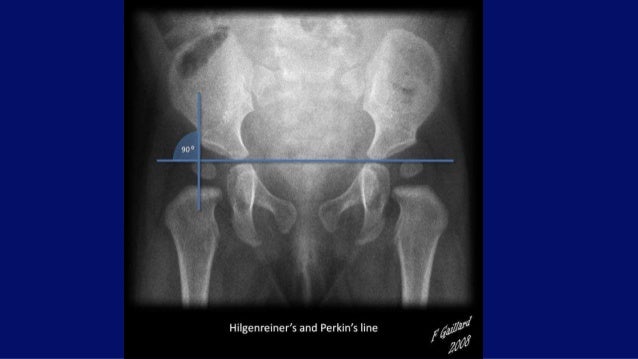 mri vs xray