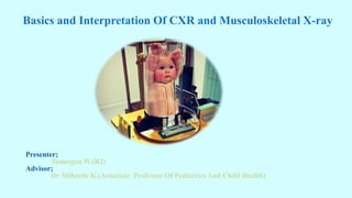 Basics and Interpretation Of CXR and Musculoskeletal X-ray
Presenter;
Temesgen W.(R2)
Advisor;
Dr Mihretie K.(Associate Professor Of Pediatrics And Child Health)
 