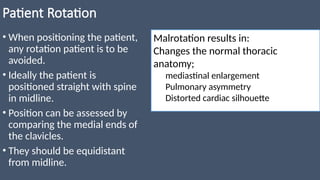 Patient Rotation Cxr Example XRAY Interpretation for medical students | PPTX