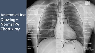XRAY Interpretation for medical students | PPTX