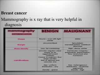 Role of x ray in diagnosis of malignancy.pptx