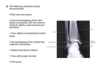 X ray of foot and ankle | PPTX