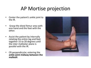 X ray of foot and ankle | PPTX
