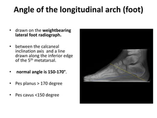 X ray of foot and ankle | PPTX