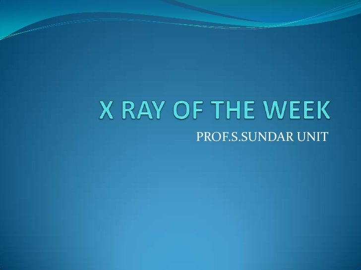 X Ray: Chest-Homogenous opacity
