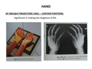 Xray ortho | PPTX