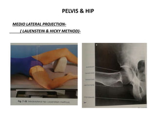 Lowenstein Rx Xray ortho | PPTX
