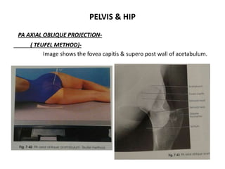 Xray ortho | PPTX