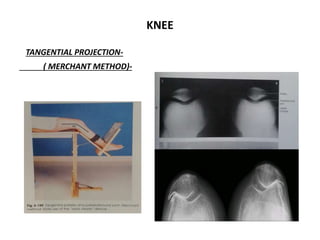 Xray ortho | PPTX
