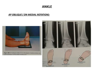 Lateral Rotation Of Ankle Rotation Xray ortho | PPTX