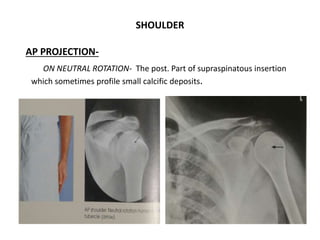 Xray ortho | PPTX