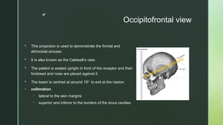 z
Occipitofrontal view
 This projection is used to demonstrate the frontal and
ethmoidal sinuses.
 It is also known as the Caldwell’s view.
 The patient is seated upright in front of the receptor and their
forehead and nose are placed against it.
 The beam is centred at around 15 to exit at the nasion.
⁰
• collimation
• lateral to the skin margins
• superior and inferior to the borders of the sinus cavities
 