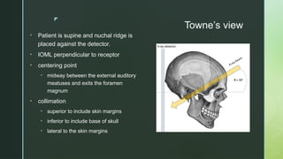 z
Towne’s view
• Patient is supine and nuchal ridge is
placed against the detector.
• IOML perpendicular to receptor
• centering point
• midway between the external auditory
meatuses and exits the foramen
magnum
• collimation
• superior to include skin margins
• inferior to include base of skull
• lateral to the skin margins
 