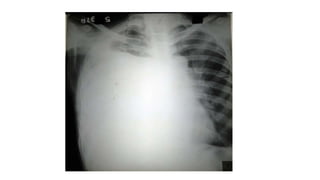 X RAY PRESENTATION.pptx