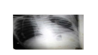 X RAY PRESENTATION.pptx