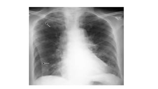 X RAY PRESENTATION.pptx