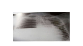 X RAY PRESENTATION.pptx