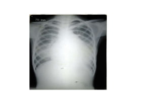 X RAY PRESENTATION.pptx