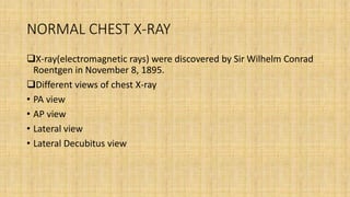 NORMAL CHEST X-RAY
X-ray(electromagnetic rays) were discovered by Sir Wilhelm Conrad
Roentgen in November 8, 1895.
Different views of chest X-ray
• PA view
• AP view
• Lateral view
• Lateral Decubitus view
 