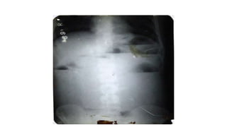 X RAY PRESENTATION.pptx