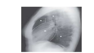 X RAY PRESENTATION.pptx