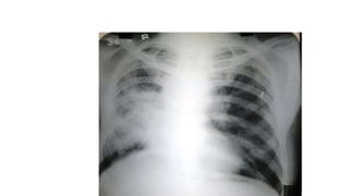 X RAY PRESENTATION.pptx
