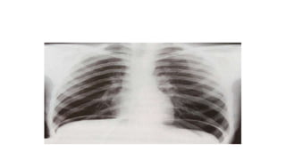X RAY PRESENTATION.pptx