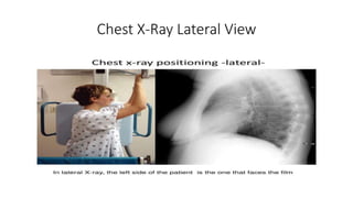 Chest X-Ray Lateral View
 