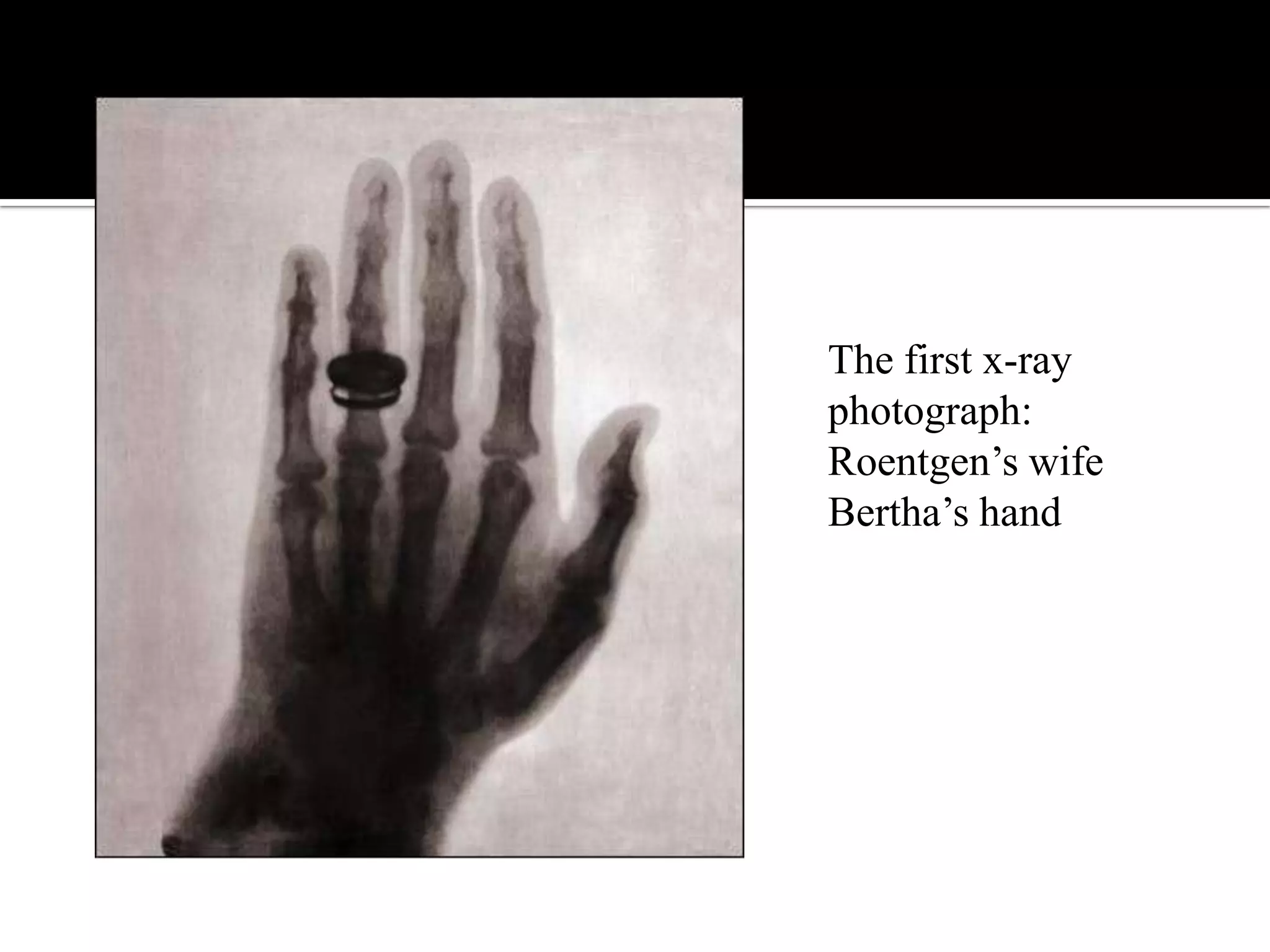 The first x-ray
photograph:
Roentgen‟s wife
Bertha‟s hand

 