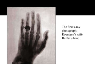 The first x-ray
photograph:
Roentgen‟s wife
Bertha‟s hand

 