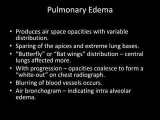 Pulmonary Edema

• Produces air space opacities with variable
  distribution.
• Sparing of the apices and extreme lung bases.
• “Butterfly” or “Bat wings” distribution – central
  lungs affected more.
• With progression – opacities coalesce to form a
  “white-out” on chest radiograph.
• Blurring of blood vessels occurs.
• Air bronchogram – indicating intra alveolar
  edema.
 