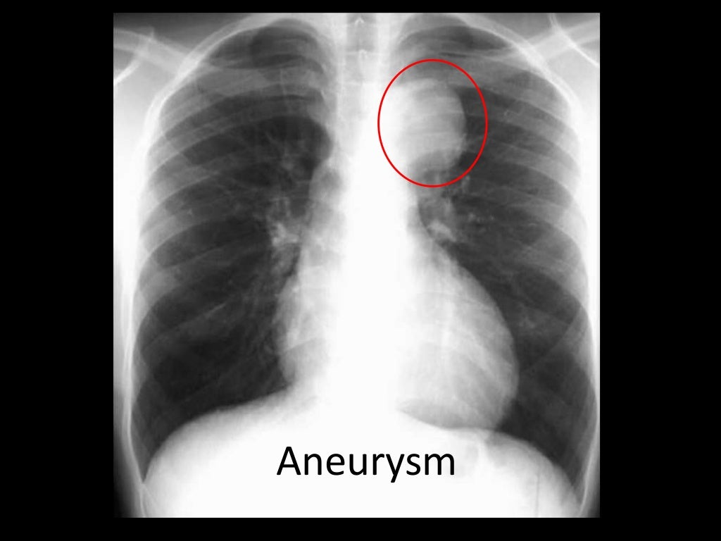 Medicine Xrays